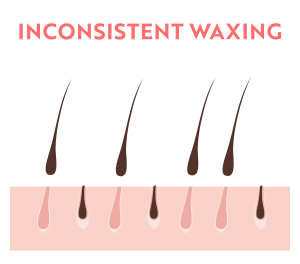 The Shaving Effect with Inconsistent Waxing