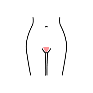 G String Wax Diagram