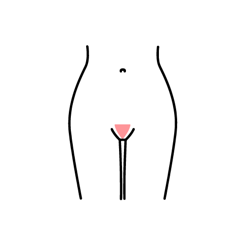 G String Wax Diagram