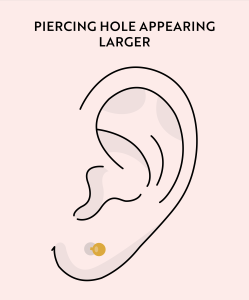 Signs of Piercing Migration More Essential Beauty Piercing