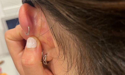 Infected earring sales