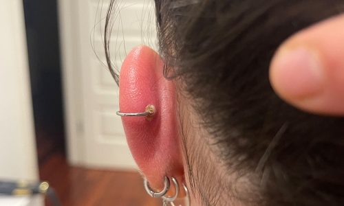 How To Treat Piercing Infections Essential Beauty And Piercing 