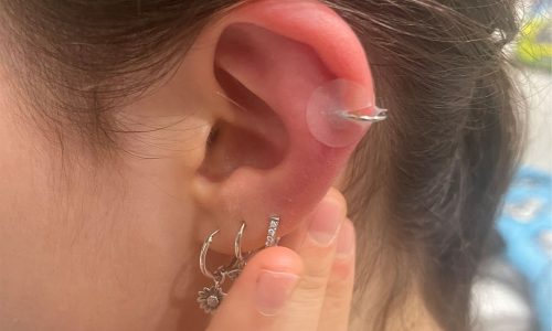 Ear Piercing Infections Bumps- H2Ocean