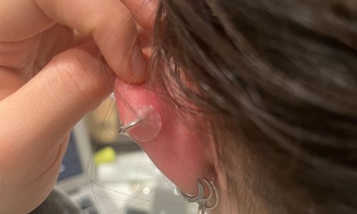 High Quality? Part 12 – Lumps and Bumps - Rogue Piercing