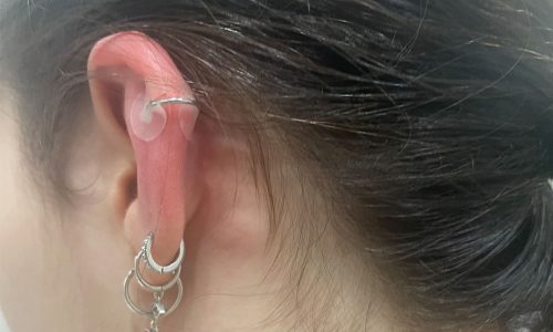 How to know if your daith piercing is infected - Quora