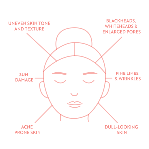 Microdermabrasion Facial Service Essential Beauty