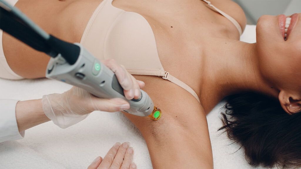 laser hair reduction